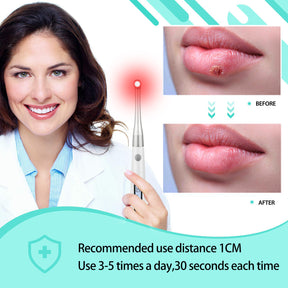 Bliofo Cold Sore Device for Pain Relief